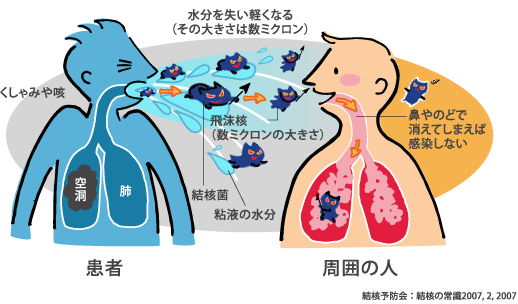 感染